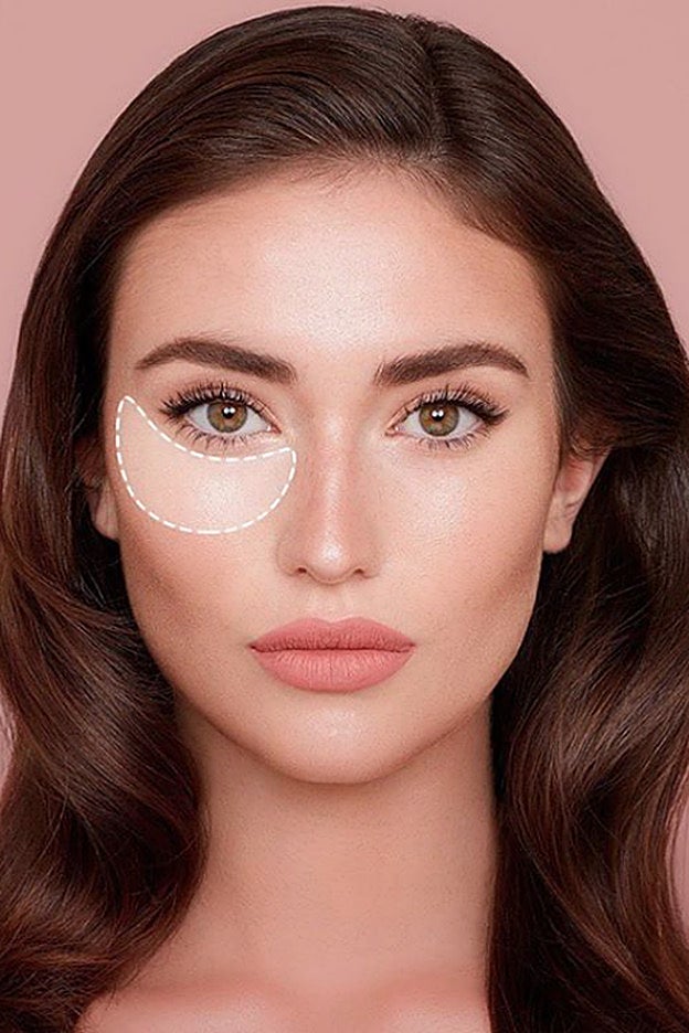 Todos los retoques que se hacen en la cara necesitan bastante tiempo de recuperación.