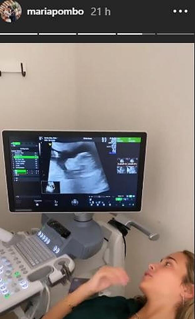 María Pombo muestra la primera ecografía de su bebé.