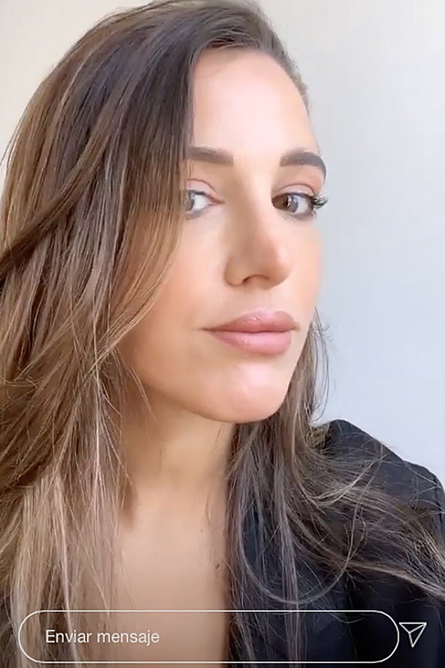 Resultado final de los labios con extra de volumen de Teresa Bass.