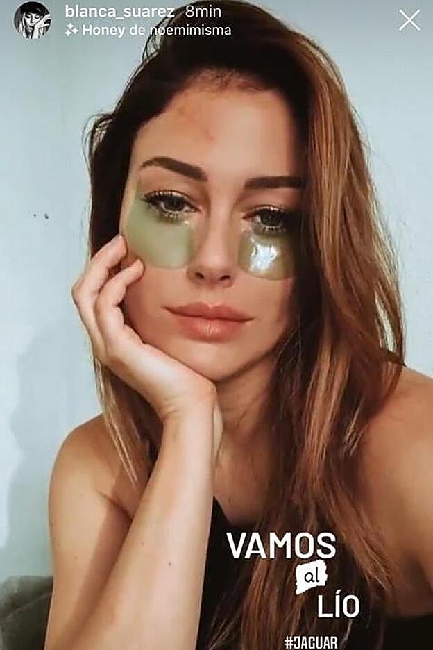 Blanca Suárez con unos parches para el contorno de ojos.