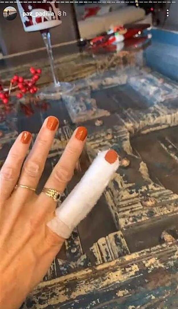 Así ha decorado Padilla su venda.