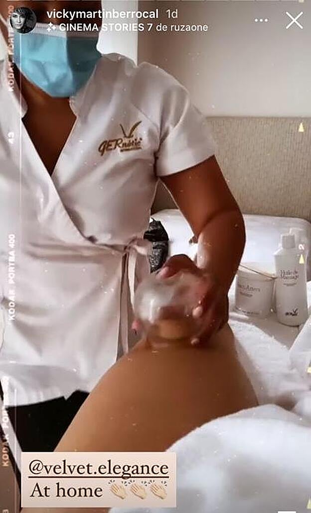 Vicky MArtín Berrocal en Instagram, enseñando el tratamiento con ventosas que se ha hecho en las piernas.