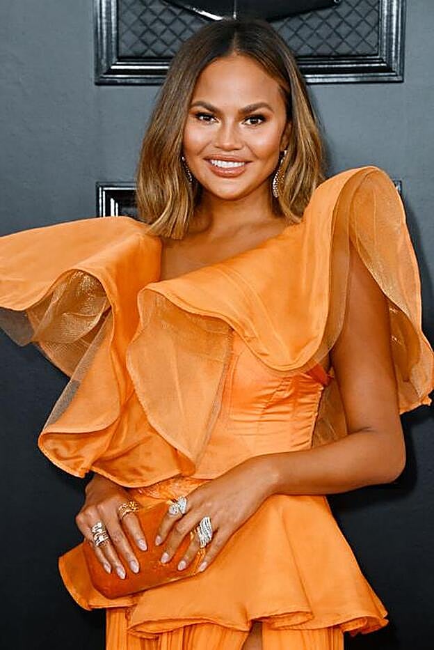 La modelo comparte en sus redes coailes todo tipo de problemas ginecológicos, desde la infertilidad a su reciente operación de endometriosis.