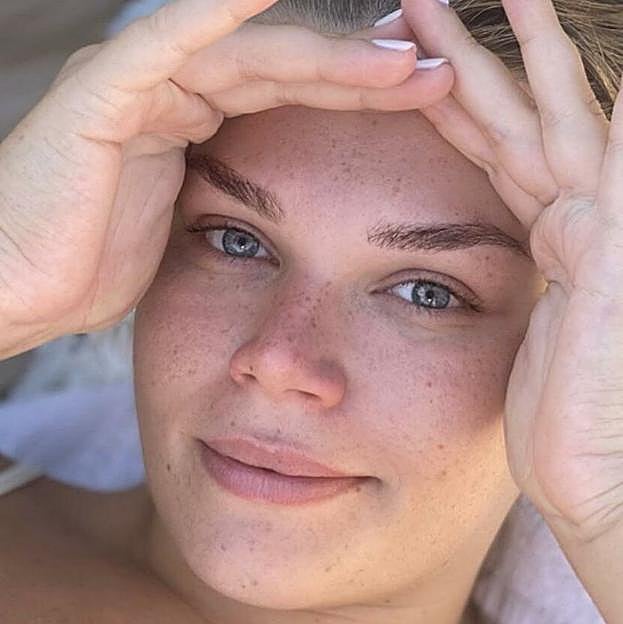 Camille Gottlieb y sus pecas sin filtro en Instagram