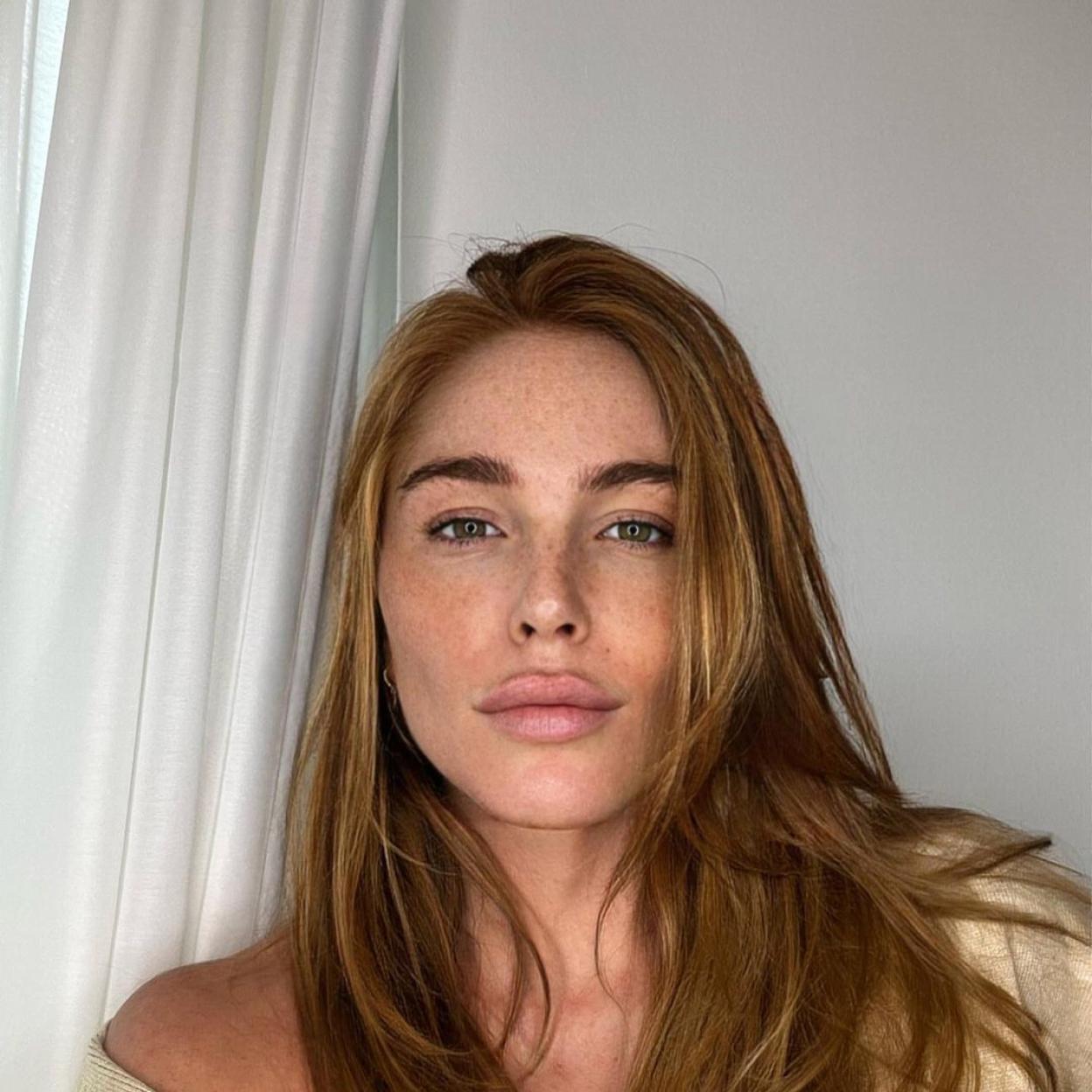 La influencer luce un rostro a cara lavada sin maquillaje que deja ver las pecas de la cara. 