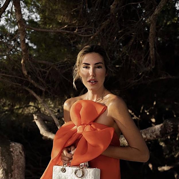 Tres labiales efecto bótox que simulan los retoques estéticos de labios más demandados