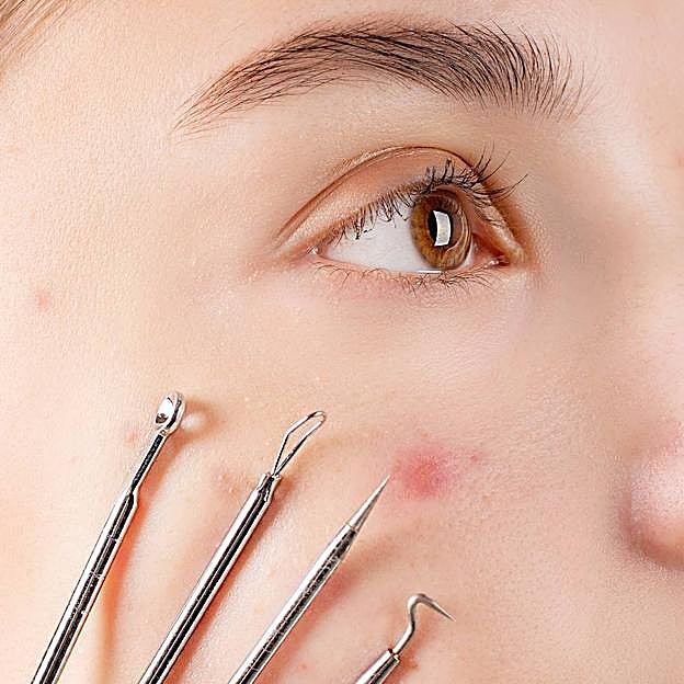 Extractores de puntos negros