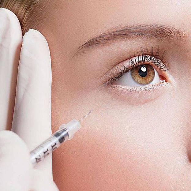 Inyecciones de ácido hialurónico para las ojeras
