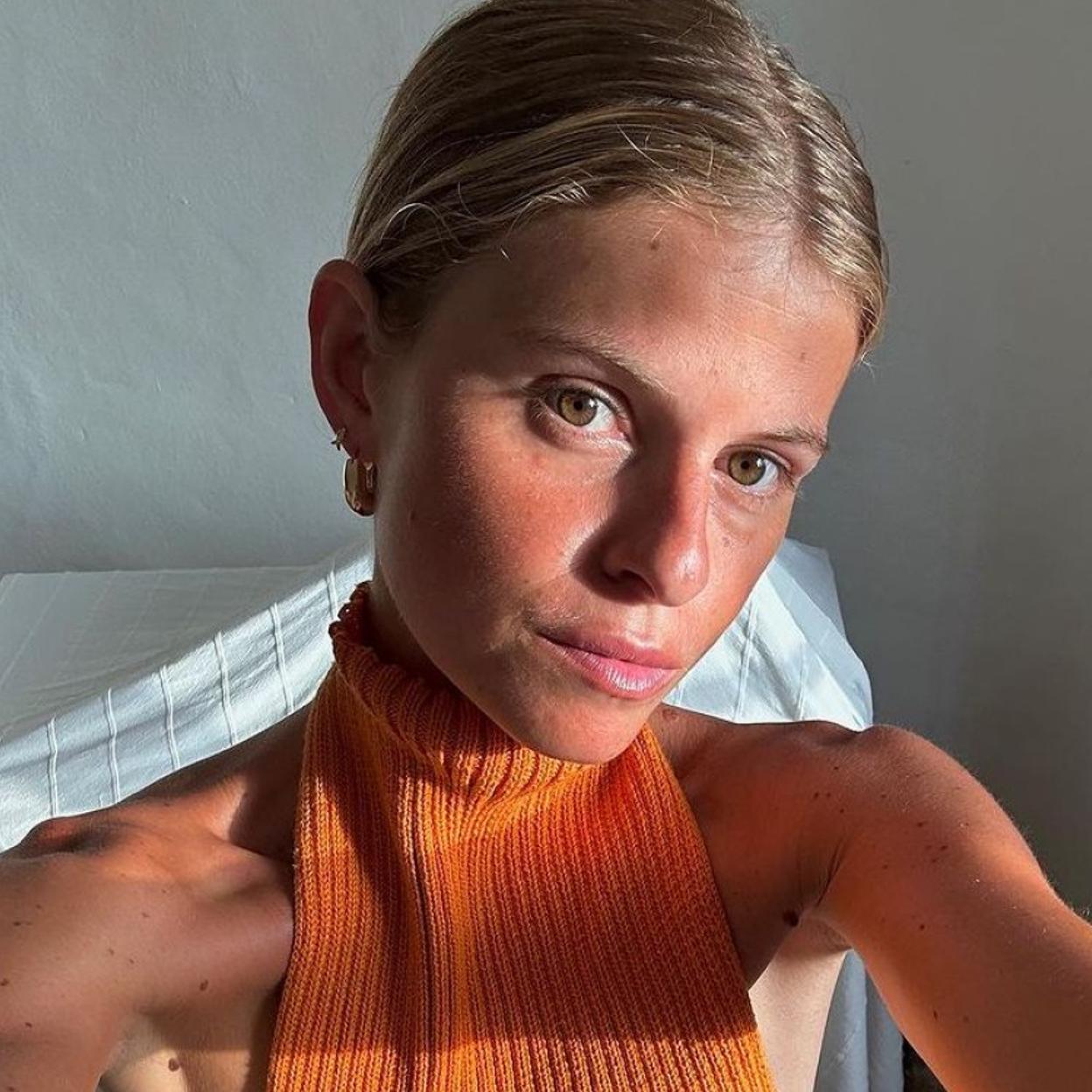 Una mujer con efecto postplaya en el rostro.