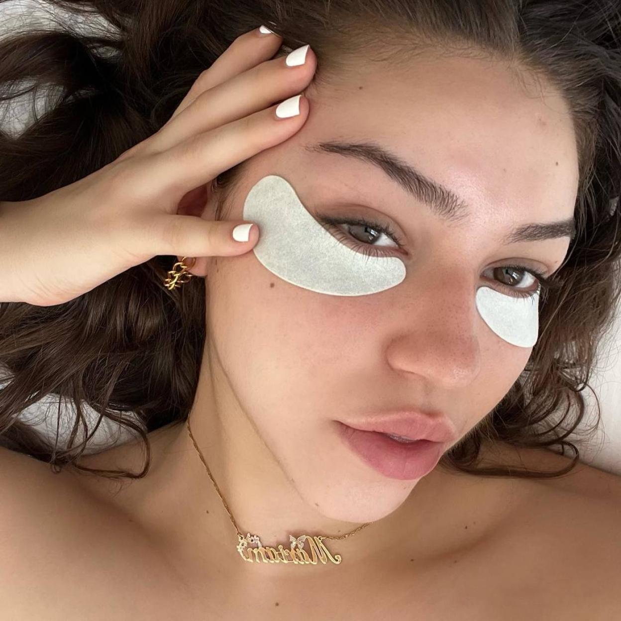 Influencer con parches de ojos