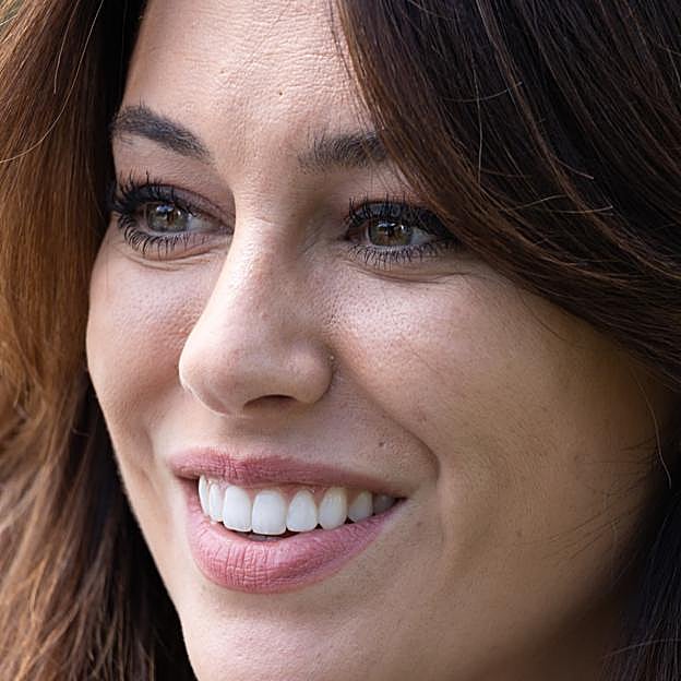 La nueva sonrisa de Blanca Suárez.