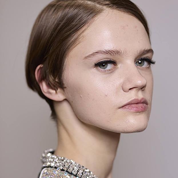 Los mejores correctores para piel con acné que disimulan los granitos todo el día