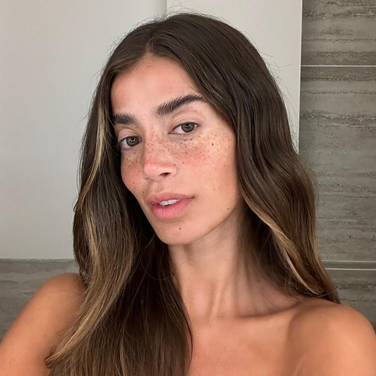 Estos son los mejores tratamientos anticaída. 