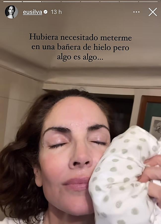 Imagen - Eugenia Silva aplicando hielo en el rostro. @eusilva.