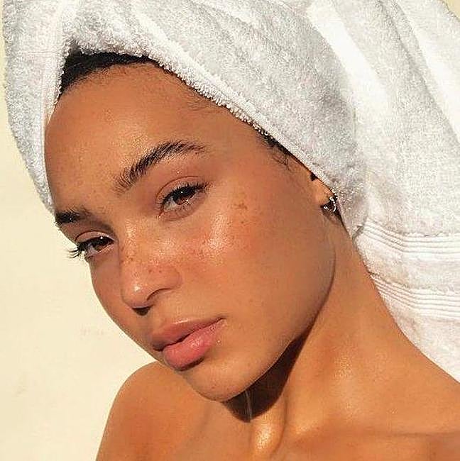 Una piel con manchas.