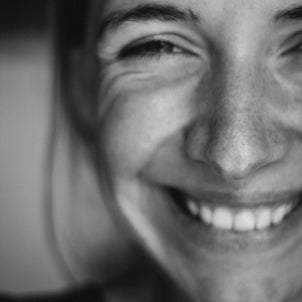 Manchas en la cara: qué las causa, cómo prevenirlas y qué tratamientos ayudan a reducirlas
