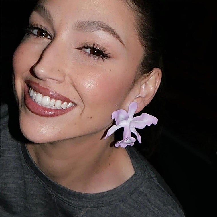Adiós a los brackets metálicos: una sonrisa perfecta con estos avances en ortodoncia