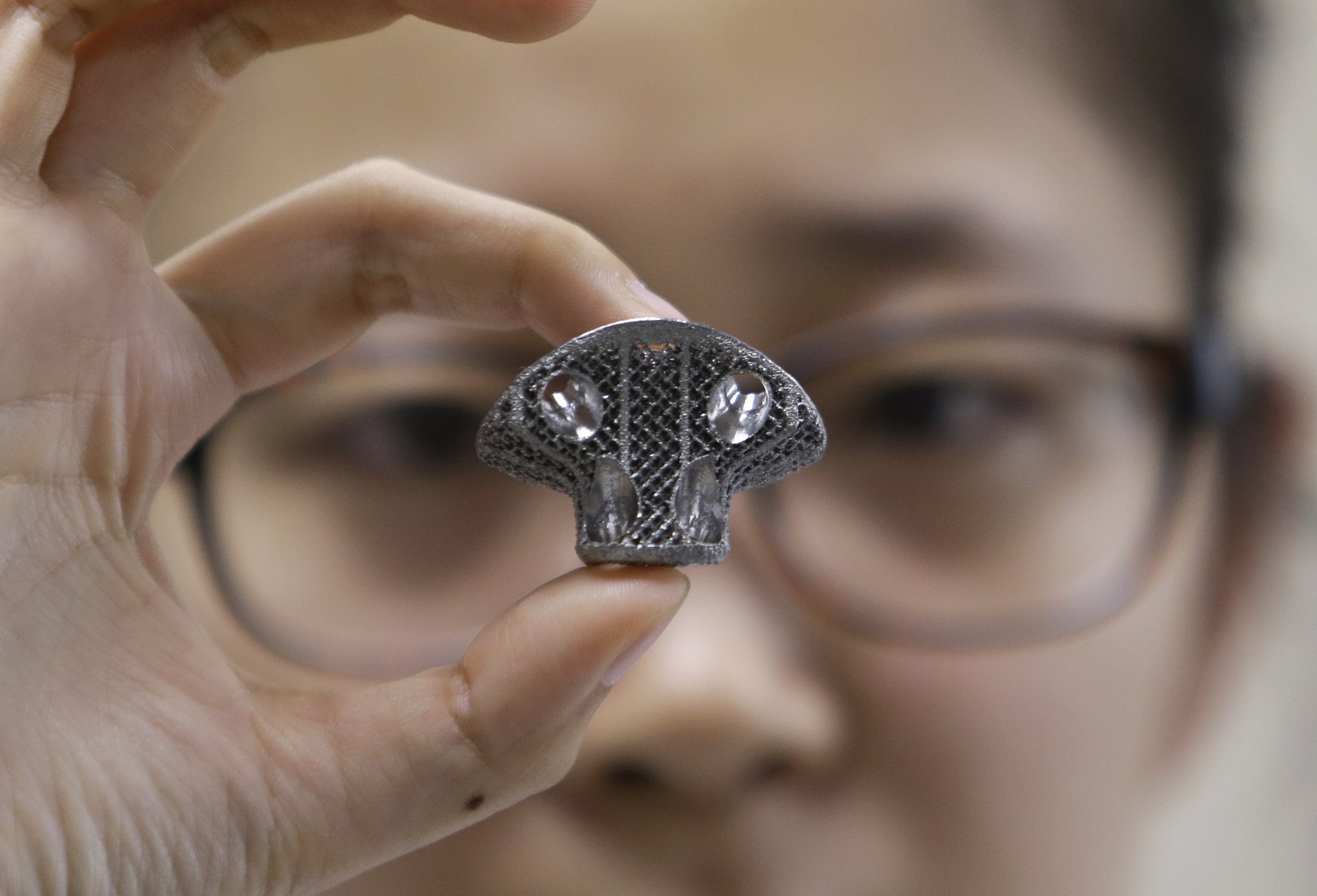 Investigadores chinos implantan una vértebra cervical impresa en 3D