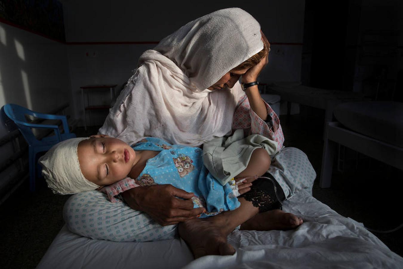 Premio a mejor fotografía en la categoría "Vida cotidiana" por "The Silent Victims Of A Forgotten War" ("Las víctimas mudas de una guerra olvidada"), donde una madre sostiene a su sobrino, herido tras una explosión en Kabul (Afganistán).