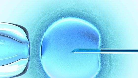 Nace un bebé con ADN de tres personas en Reino Unido