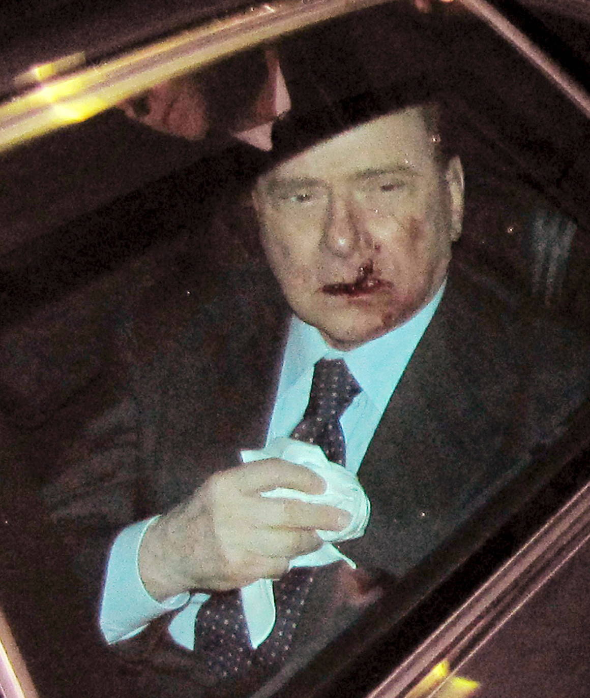 Berlusconi, en su coche, camino del hospital tras ser agredido por un joven en un mitin en Milán en 2009.