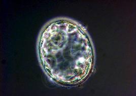 Imagen de un embrión humano de cinco días.