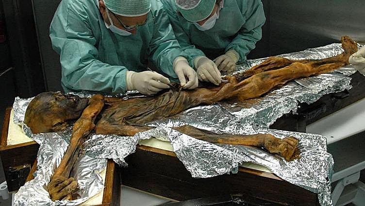 Ötzi, el hombre de hielo de los Alpes, no era tan blanco y además se le caía el pelo