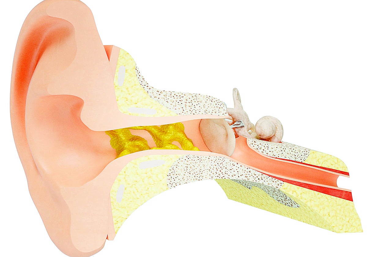 Cera en los oídos, ¡fuera bastoncillos!
