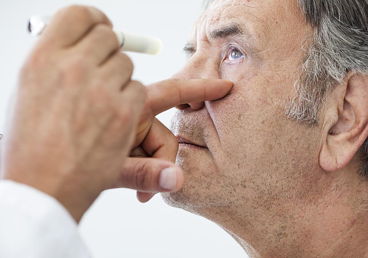 El glaucoma, la enfermedad neurodegenerativa que más afecta a la población mundial