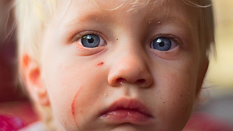 Las cremas para cicatrices que recomiendan los expertos