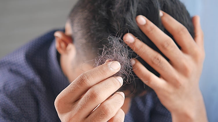 No vayas a Turquía: aquí tienes los mejores tratamientos para la alopecia