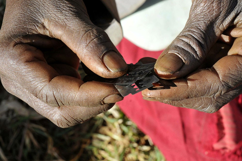 230 millones de niñas y mujeres vivas hoy día han sido sometidas a la mutilación, comúnmente realizada en países con mayorías musulmanas.