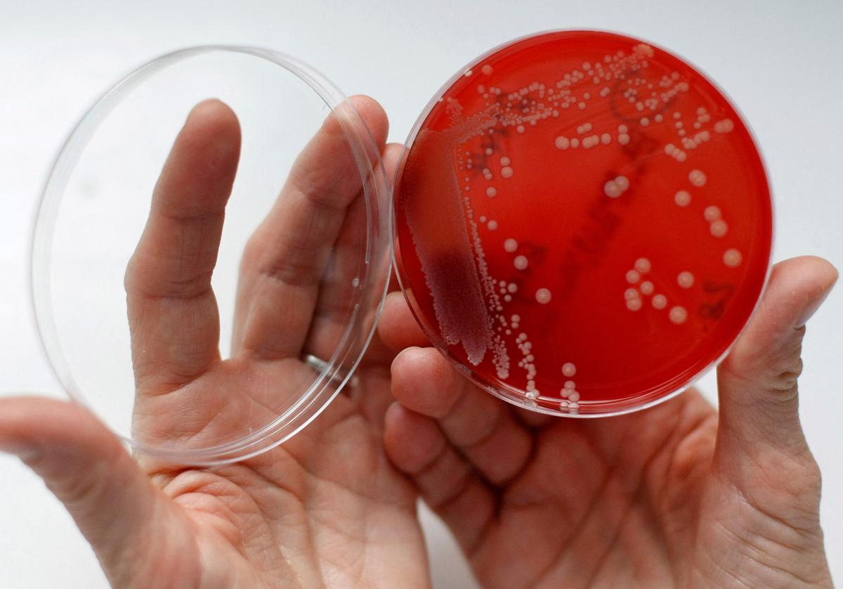 Muestra de superbacteria.