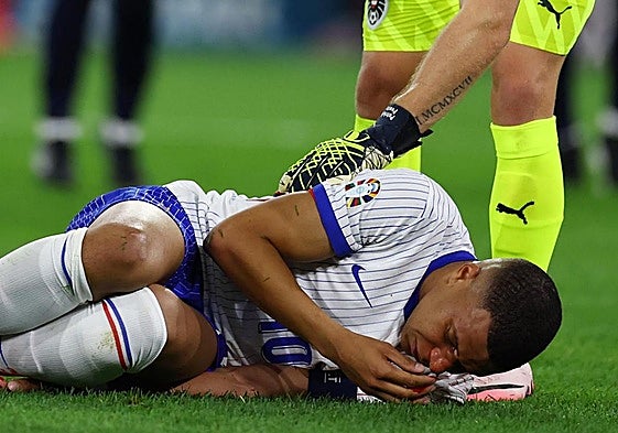 Kylian Mbappé esquiva el quirófano y jugará con una máscara