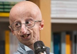 Samy Basso, el enfermo de progeria más longevo del mundo, falleció la semana pasada a los 28 años, el doble de la esperanza de vida de los pacientes con este trastorno genético.