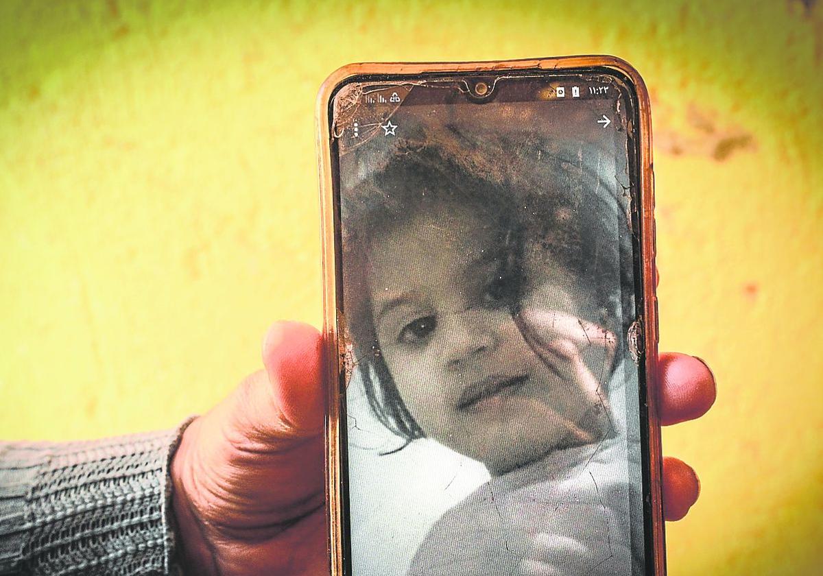 Zainbu Mohamed muestra una foto de su hija Naha, de 4 años, que debe ser intervenida de urgencia.