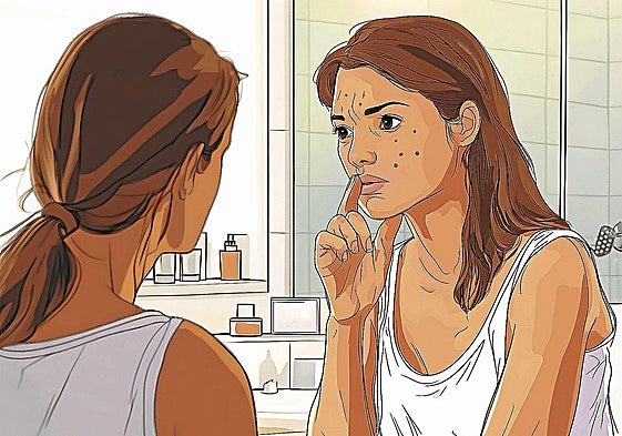 Esta es la razón por la que siempre nos sale acné antes de un evento importante