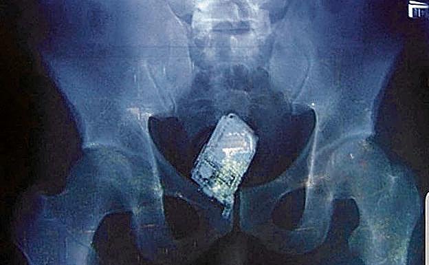La radiografía muestra un teléfono móvil oculto en el ano de un recluso.