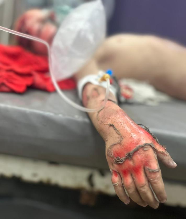 Imagen secundaria 2 - Otros de los pacientes atendidos por el anestesista Raúl Incertis.