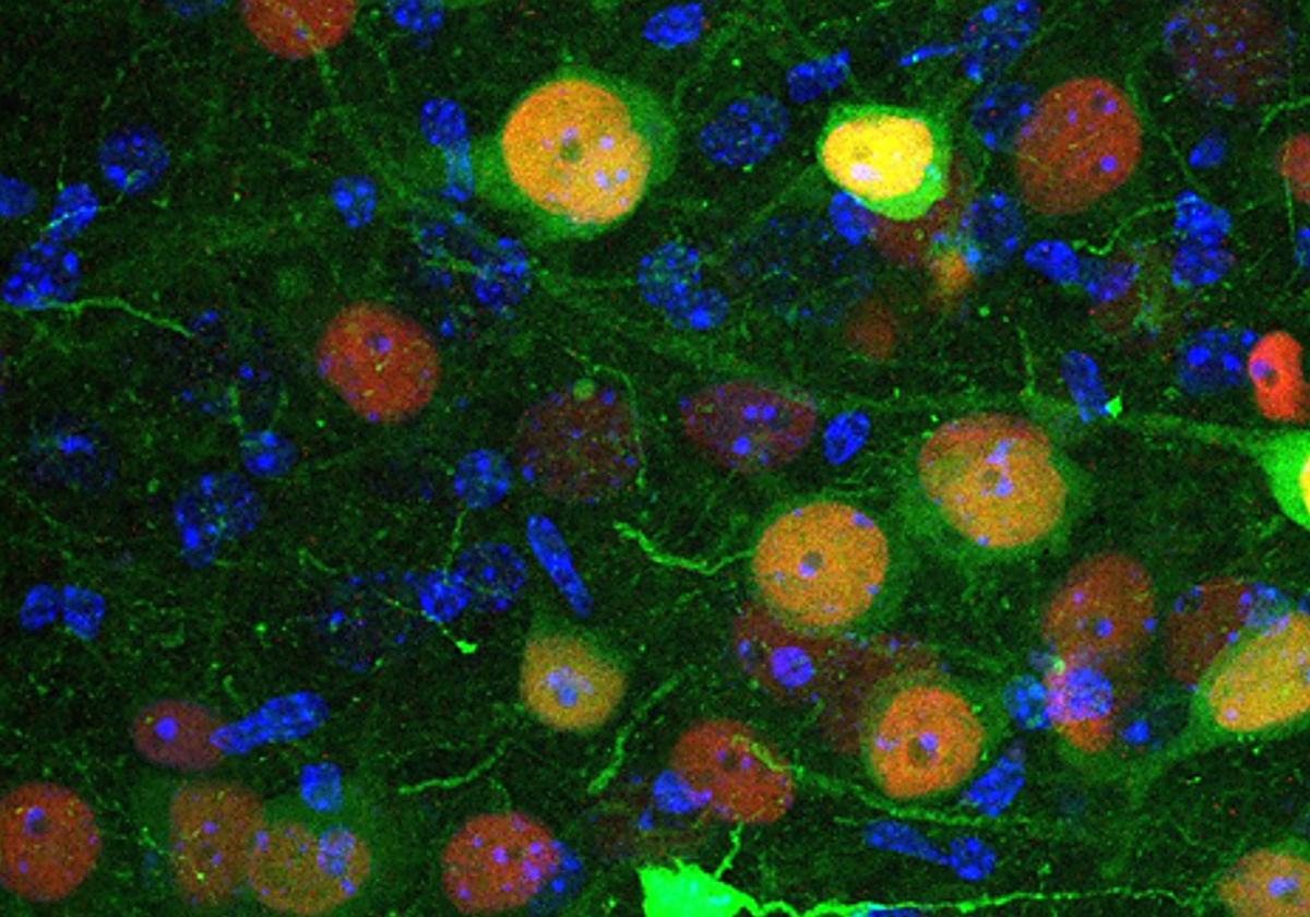 Neuronas de la amígdala, la región cerebral que regula las emociones.
