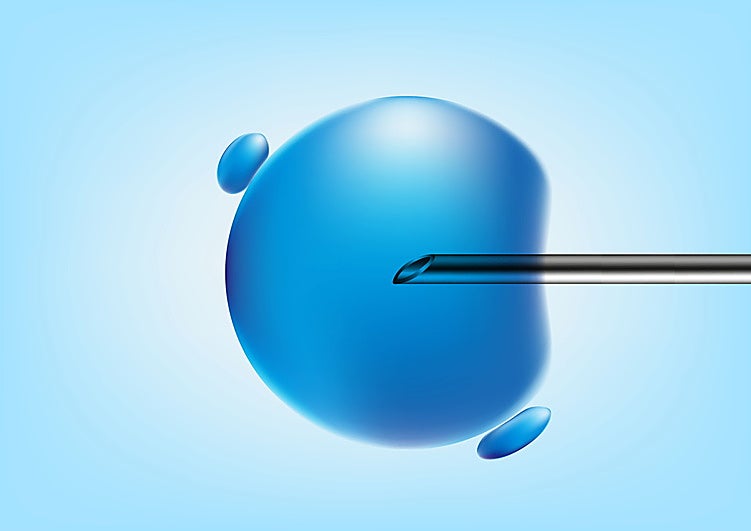 Ocho bebés nacen sin una enfermedad hereditaria gracias a la donación de ADN