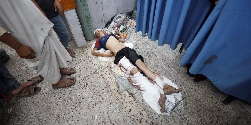 Un niño desnutrido y herido durante un bombardeo yace en el suelo del hospital Al-Shifa en Gaza City.