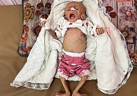 Una niña gazatí de cinco meses recibe tratamiento en Jan Yunis.