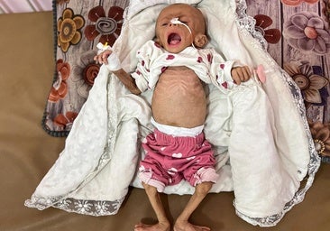 La hambruna en Gaza se agrava con 10 niños muertos más y extiende la indignación contra Israel