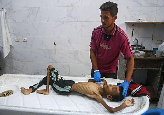 Abdul Jawad al-Ghalban, de 14 años, fallecido por desnutrición, en la morgue del hospital de Khan Jounis, la imagen del horror que sufre Gaza.