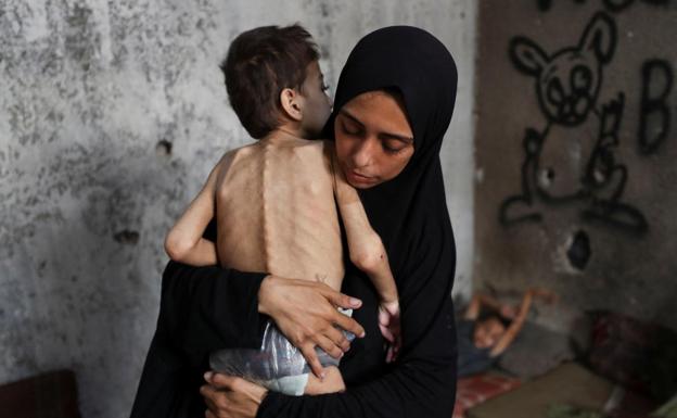 Una madre palestina sostiene a su hijo desnutrido, que sufre de parálisis cerebral, en su vivienda en Gaza.