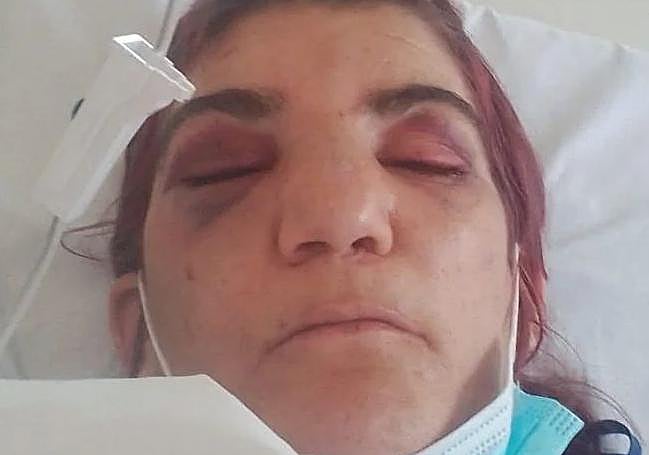 La víctima en el hospital tras ser rescatada por la Policía Local de Valencia.