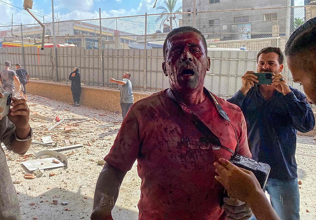 Un fotógrafo herido en el ataque al hospital Nasser, en Jan Yunis.