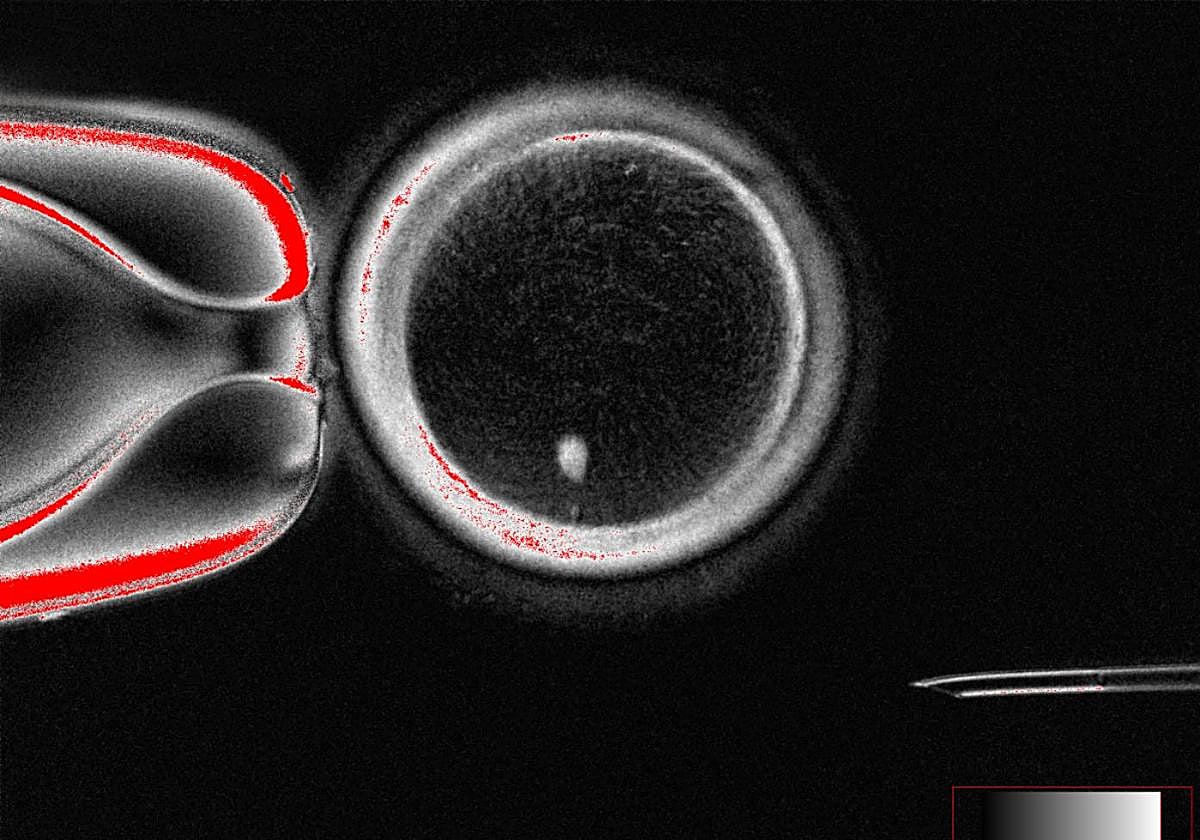 De los 82 ovocitos, solo el 9% se desarrolló hasta la llamada etapa de blastocito, cinco días después de la fecundación.
