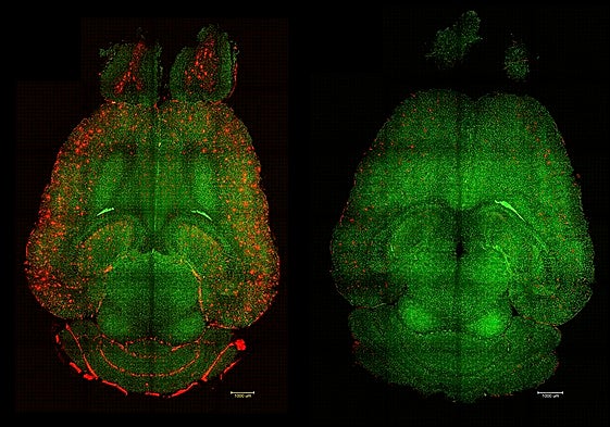 Imágenes de microscopía de fluorescencia basada en hoja de luz del cerebro de un ratón (der.) 12 horas después haber sido tratado con nanopartículas, comparado con otro de control (izq.).
